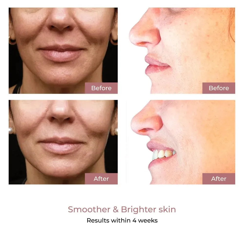 Aura Plus Light Therapy Mask sold by Able product image thumbnail 5