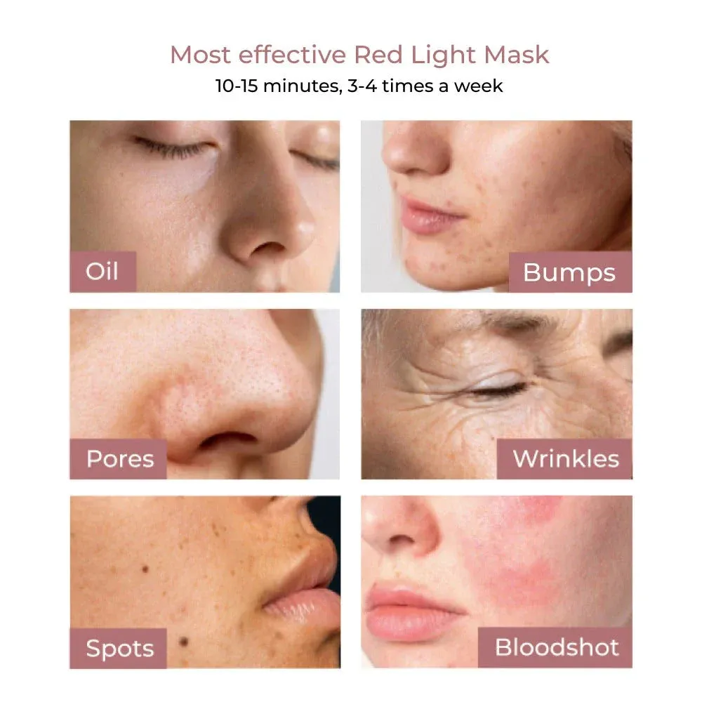 100-LED Light Therapy Mask sold by Able product image thumbnail 3