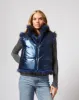 Katy Tipped Fox Faux Fur Vest sold by Adrienne Landau