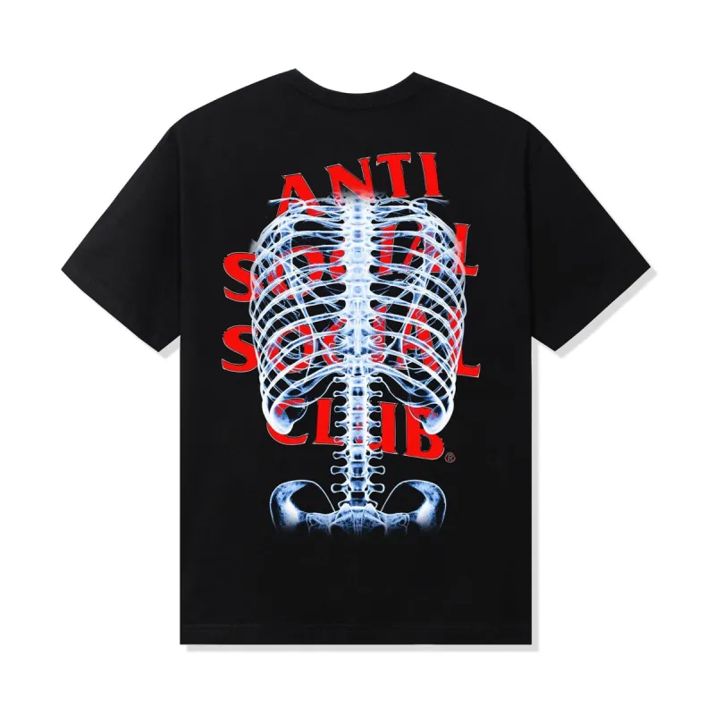 Bones Tee - Black sold by Anti Social Social Club