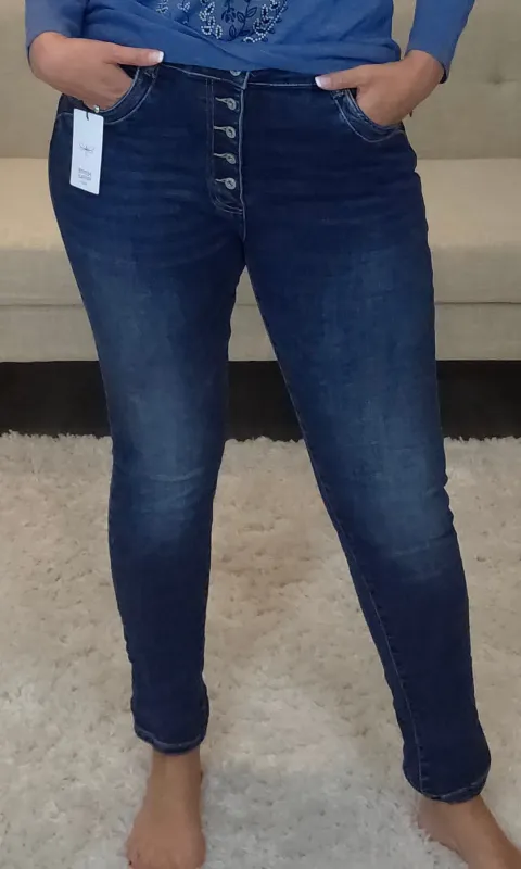 Exposed Button Fly Skinny Jean sold by Revolution Boutique