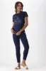 Zola Regular Fitted Graphic Tee _ 150318 _ Navy sold by Dunns