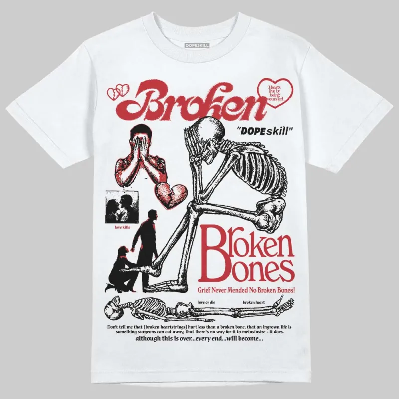 Ruby 1s DopeSkill T-Shirt Broken Bones Graphic sold by DopeSkill