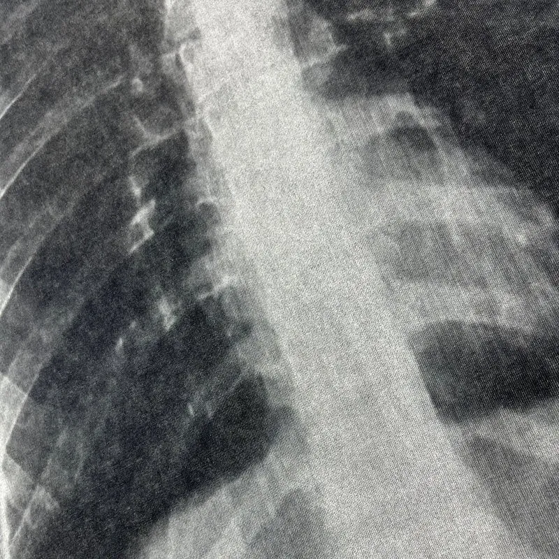 X-Ray Print Graphic T-Shirt with Red Heart Detail sold by KIIKIO product image thumbnail 3