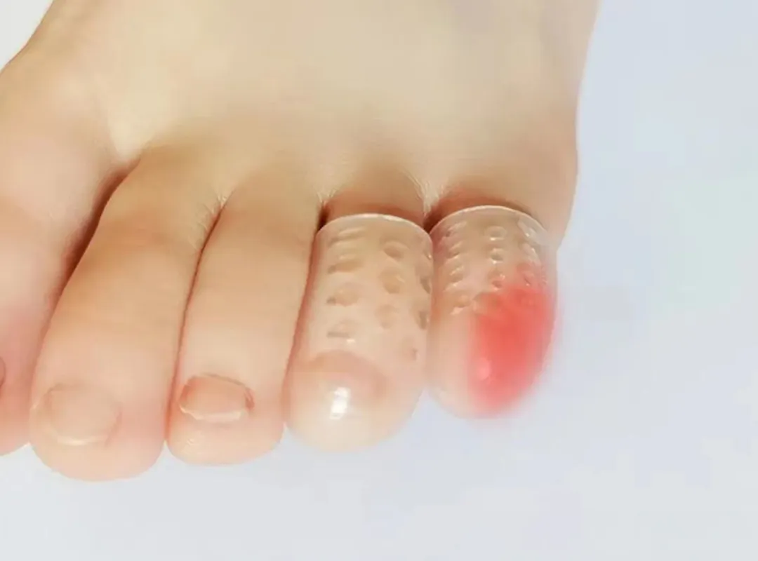FitVille Anti-Friction Toe Cover (30 Pack) sold by FitVille