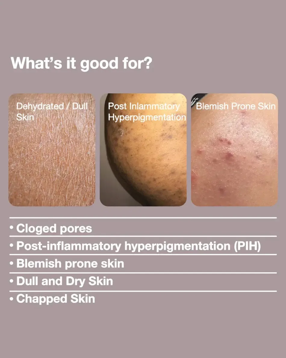 Buttface The Butt Mask (4-pack) sold by Underwear Expert product image thumbnail 3