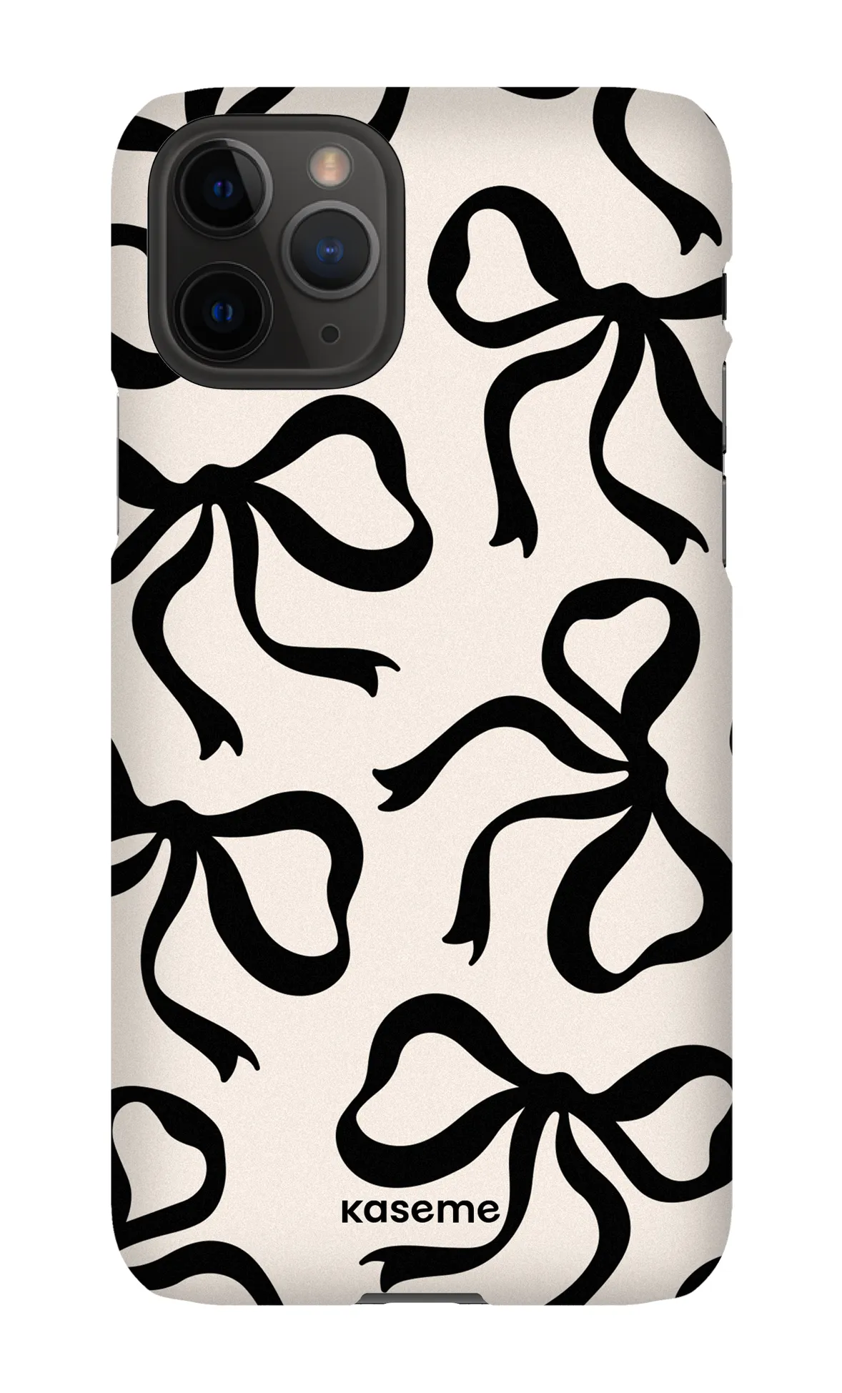 Lace Black sold by KaseMe product image thumbnail 3