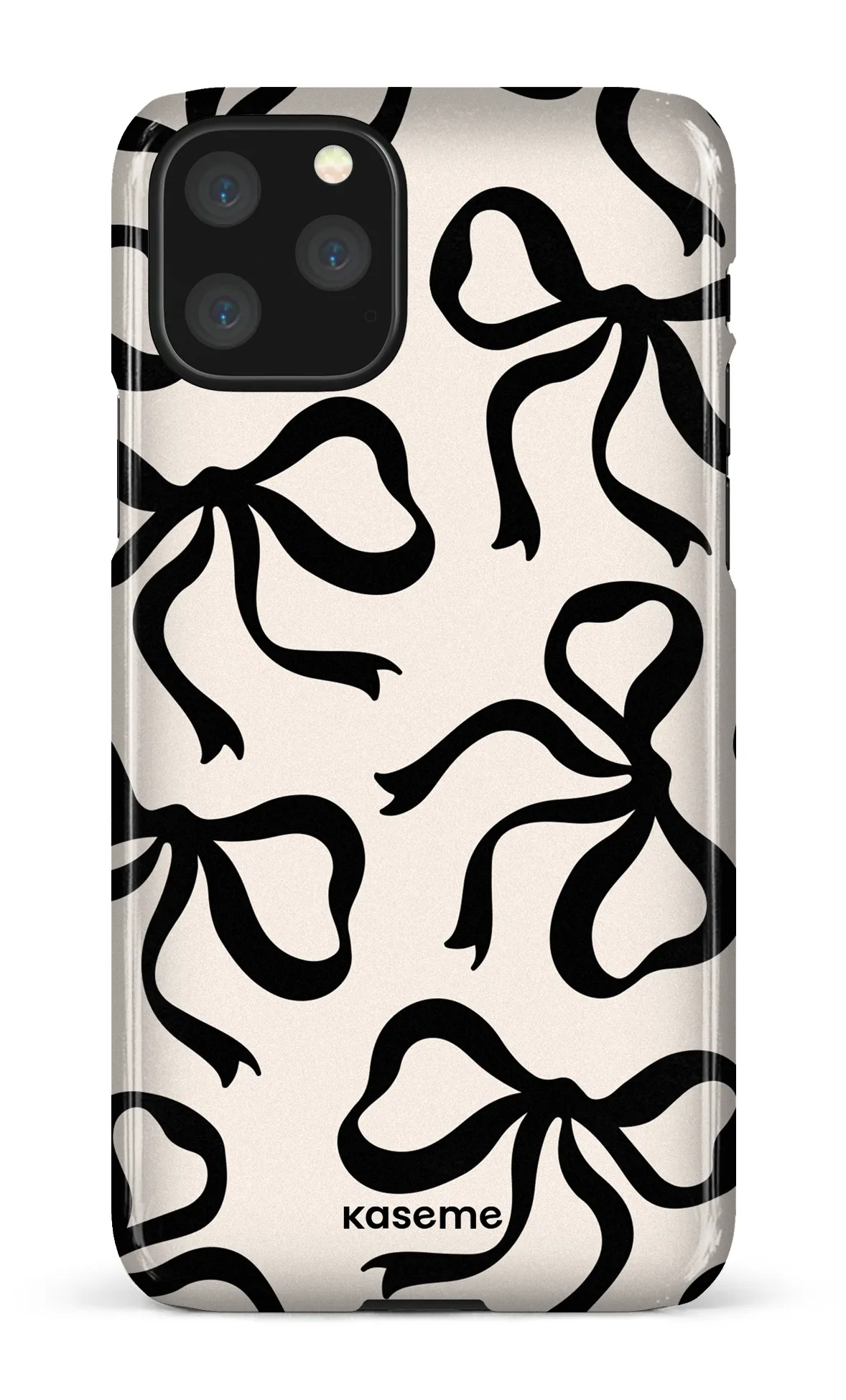 Lace Black sold by KaseMe product image thumbnail 5