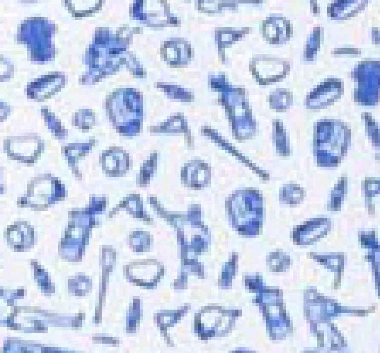 New York Yankees Rally Cap Performance Polo - Cooperstown Logo sold by Johnnie-O product image thumbnail 5